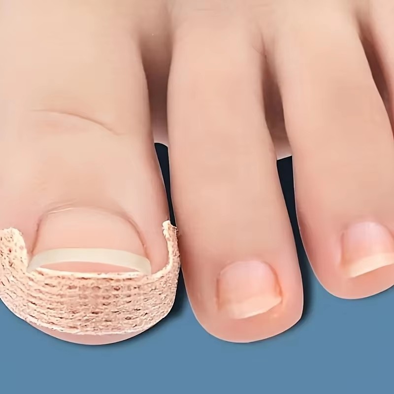 Skincare Oily Skin - 10-100Pcs Adhesive Toenail Patch Ingrown Toe