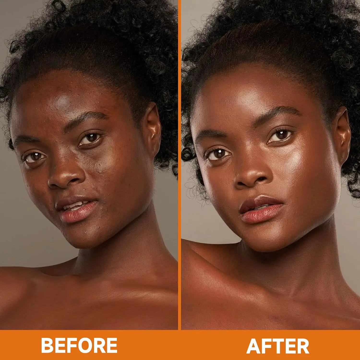 4 Pack Turmeric Kojic Acid Soa - огляд і ціна Skincare Oily Skin