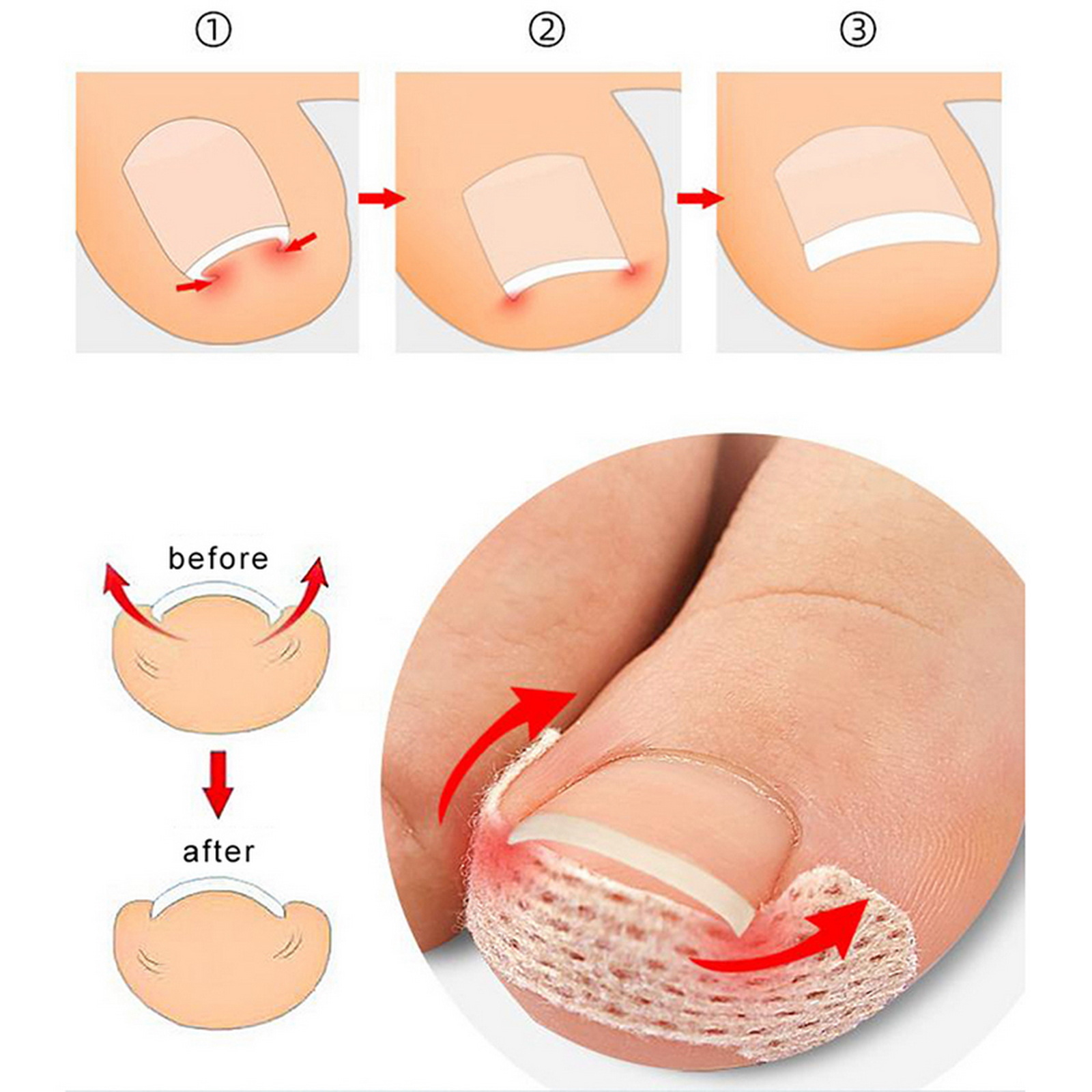 10-100Pcs Adhesive Toenail Pat - огляд і ціна Skincare Oily Skin