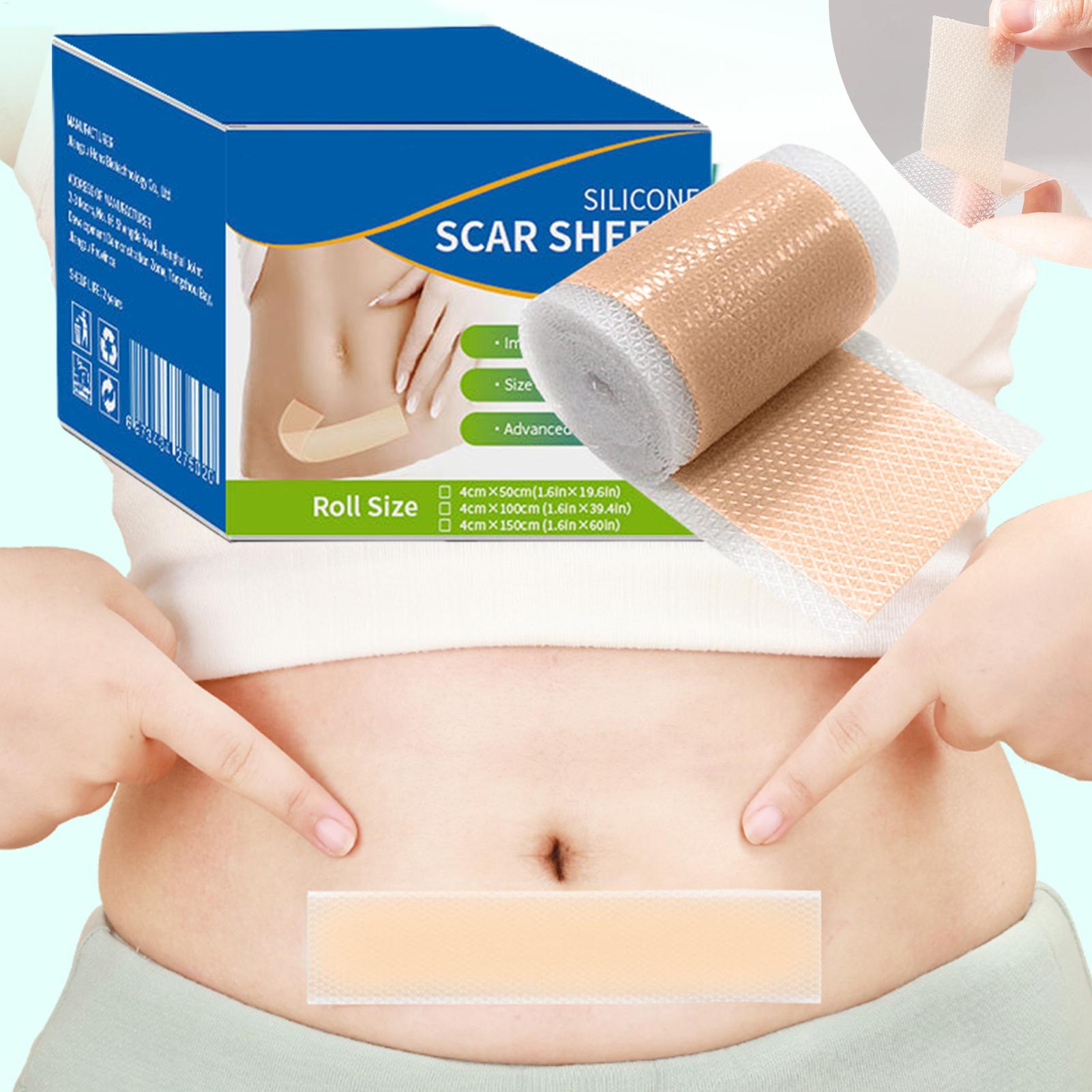 1 Roll Silicone Scar Sheets 4c - огляд і ціна Skincare Collagen